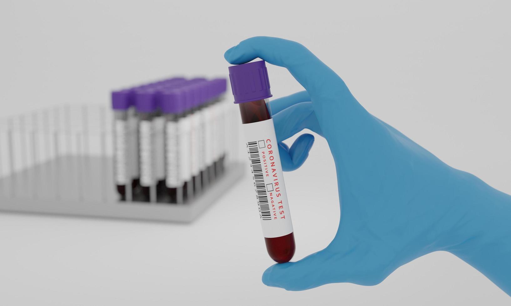 Test tubes with blood and coronavirus test label  isolated on white background. Concept for testing corona virus. 3D Rendering. photo