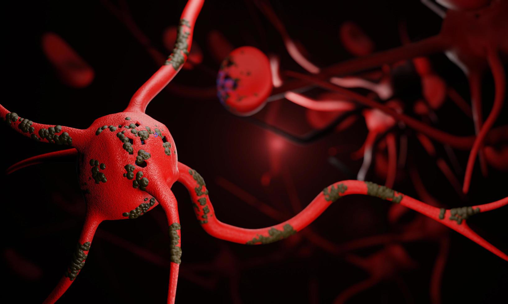 A model of neural ganglia in the body. damaged nerve endings Cause numbness, numbness of the hands and feet. Guillain Barre Syndrome concept after receiving the vaccine against COVID-19. 3D Rendering photo