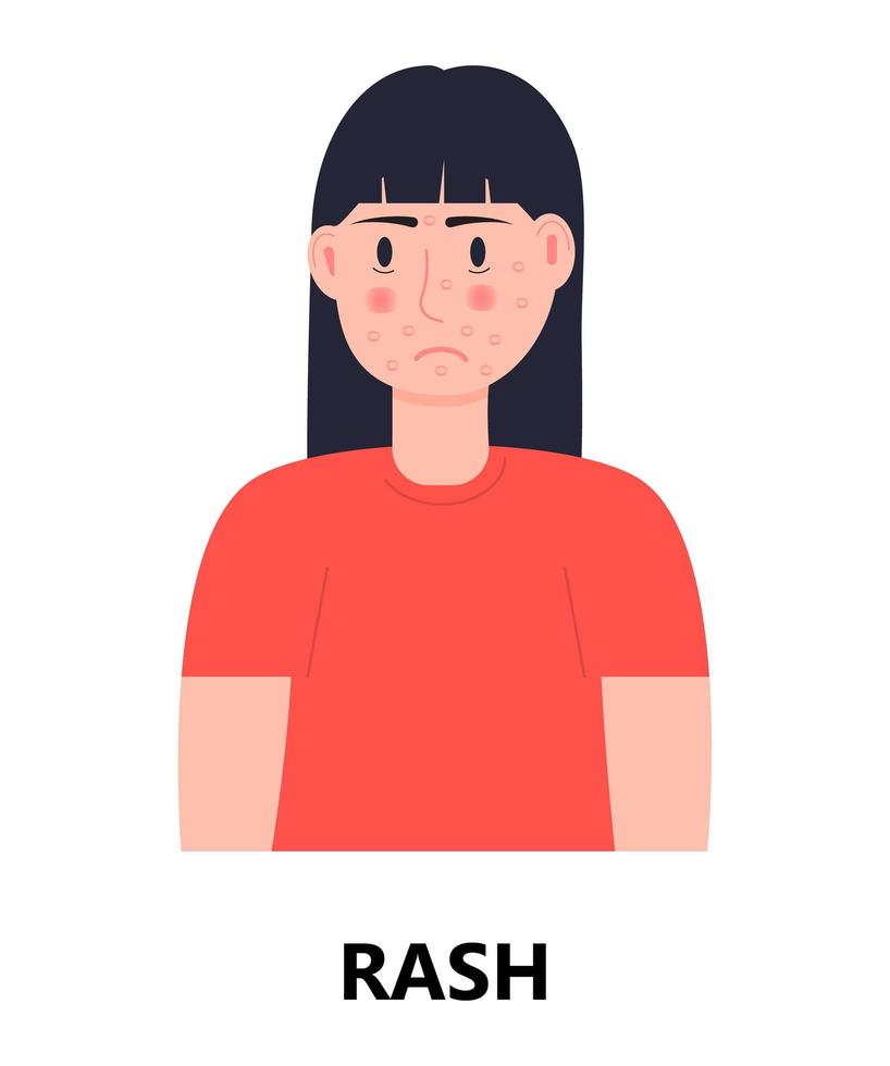 Rash icon vector. Unhappy girl with rash and acne on her face. Woman is infected by rubella, measles. Allergy, eczema illustration. Skin disease vector