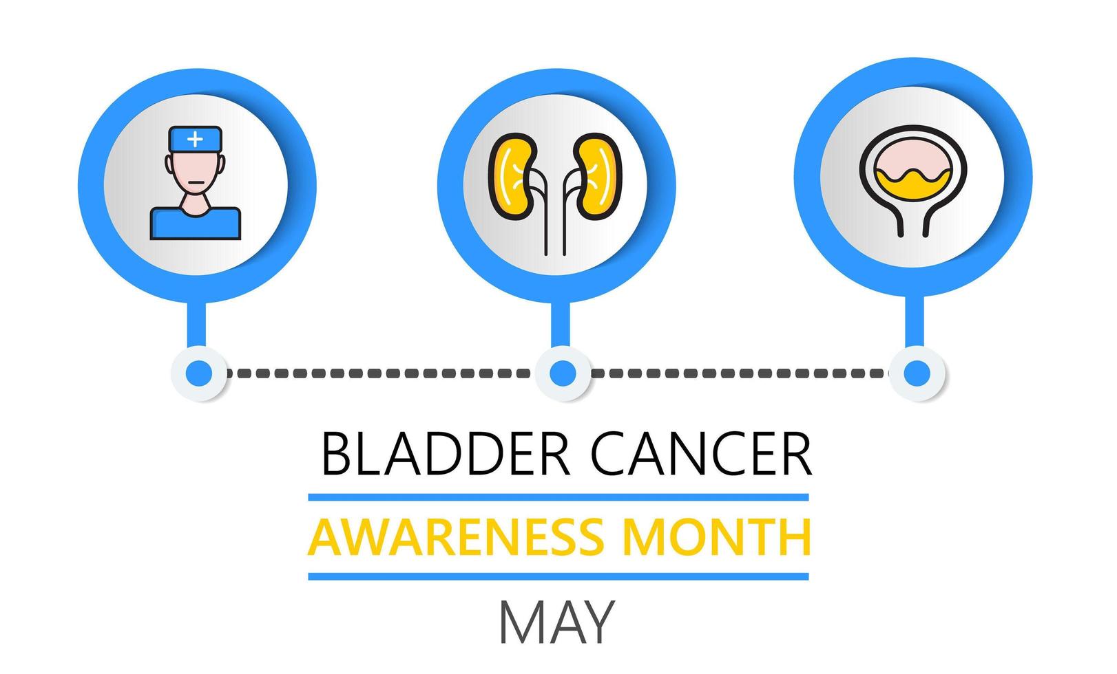 Bladder cancer awareness month is celebrated in May. Info-graphic vector of pyelonephritis, diseases. Kidneys, cystitis, bladder icons are shown. Nephropathy, renal failure, diseases