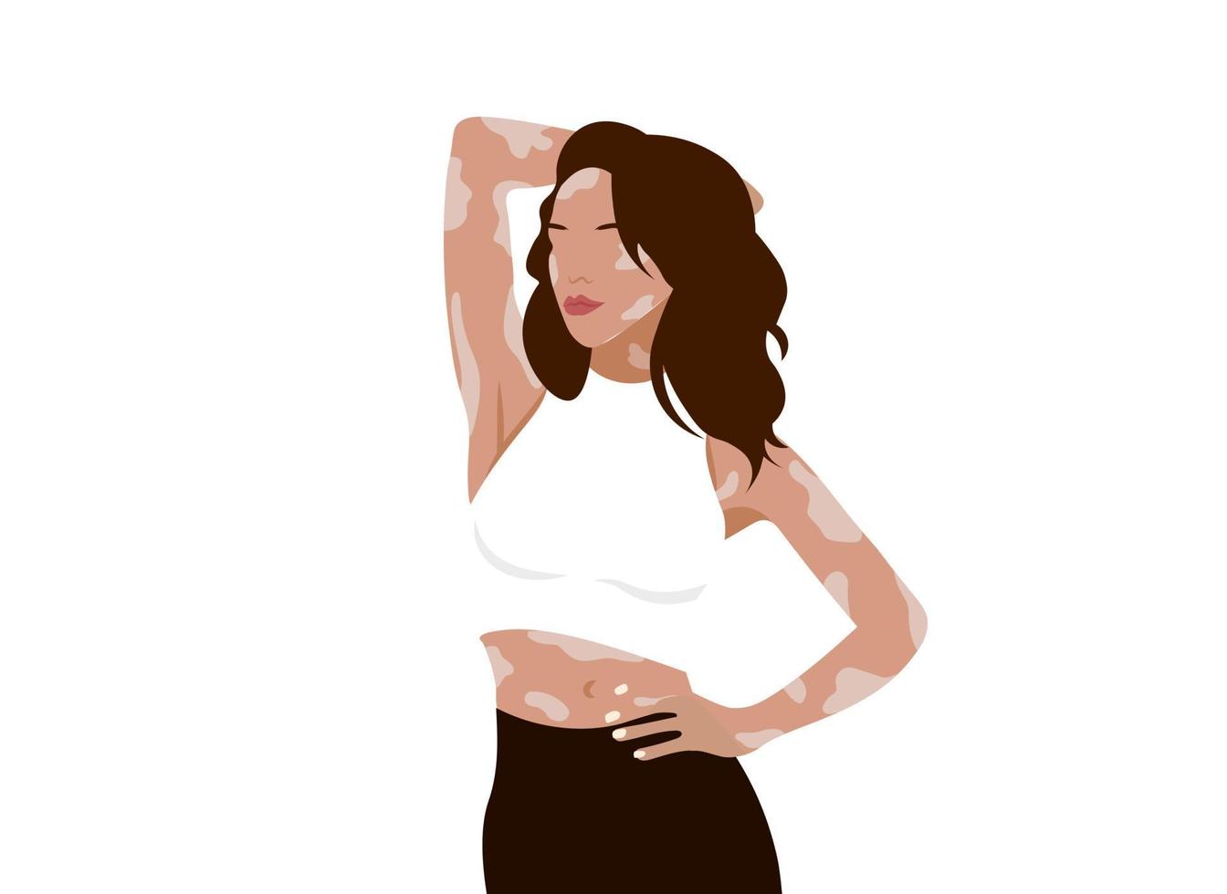 fondo estético vitiligo despigmentación piel mujer, impresión de afiche de moda aislada, concepto de aceptación de cuidado de la salud de belleza, retrato de amor de autocuidado plano de diversidad. vector