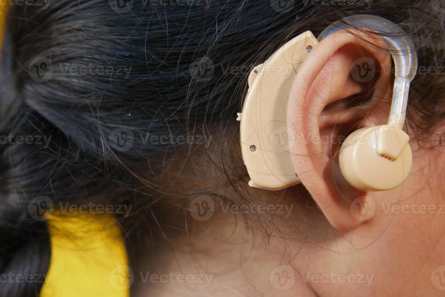 concepto de audífono, un niño con problemas de audición. foto