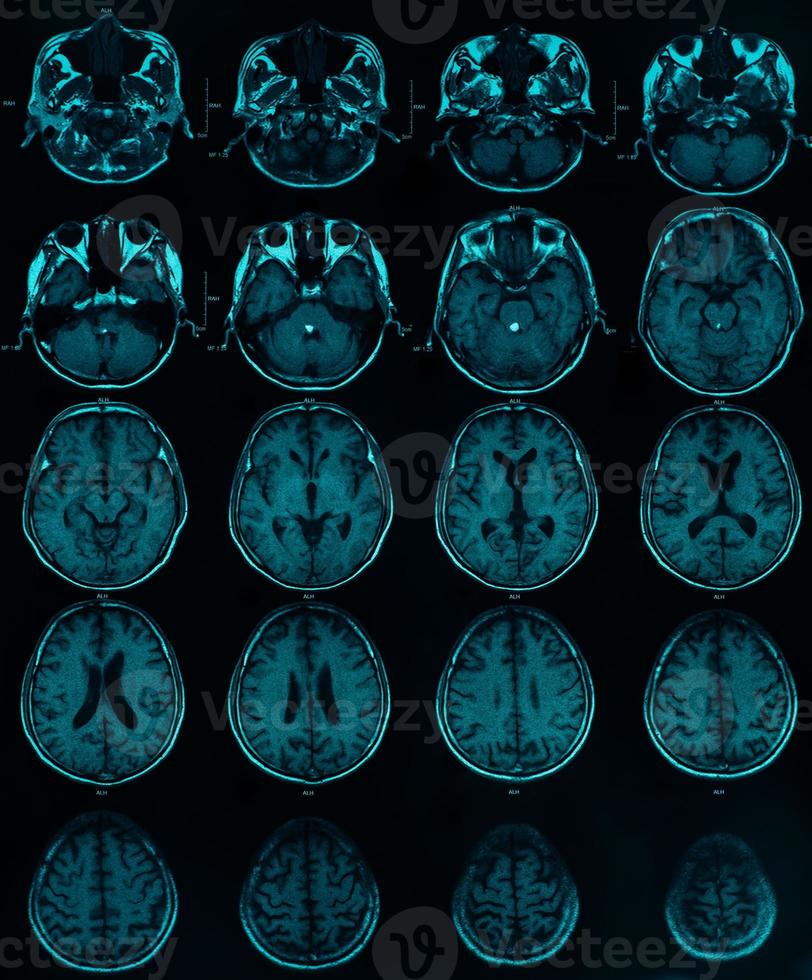 image of CT MRI brain photo