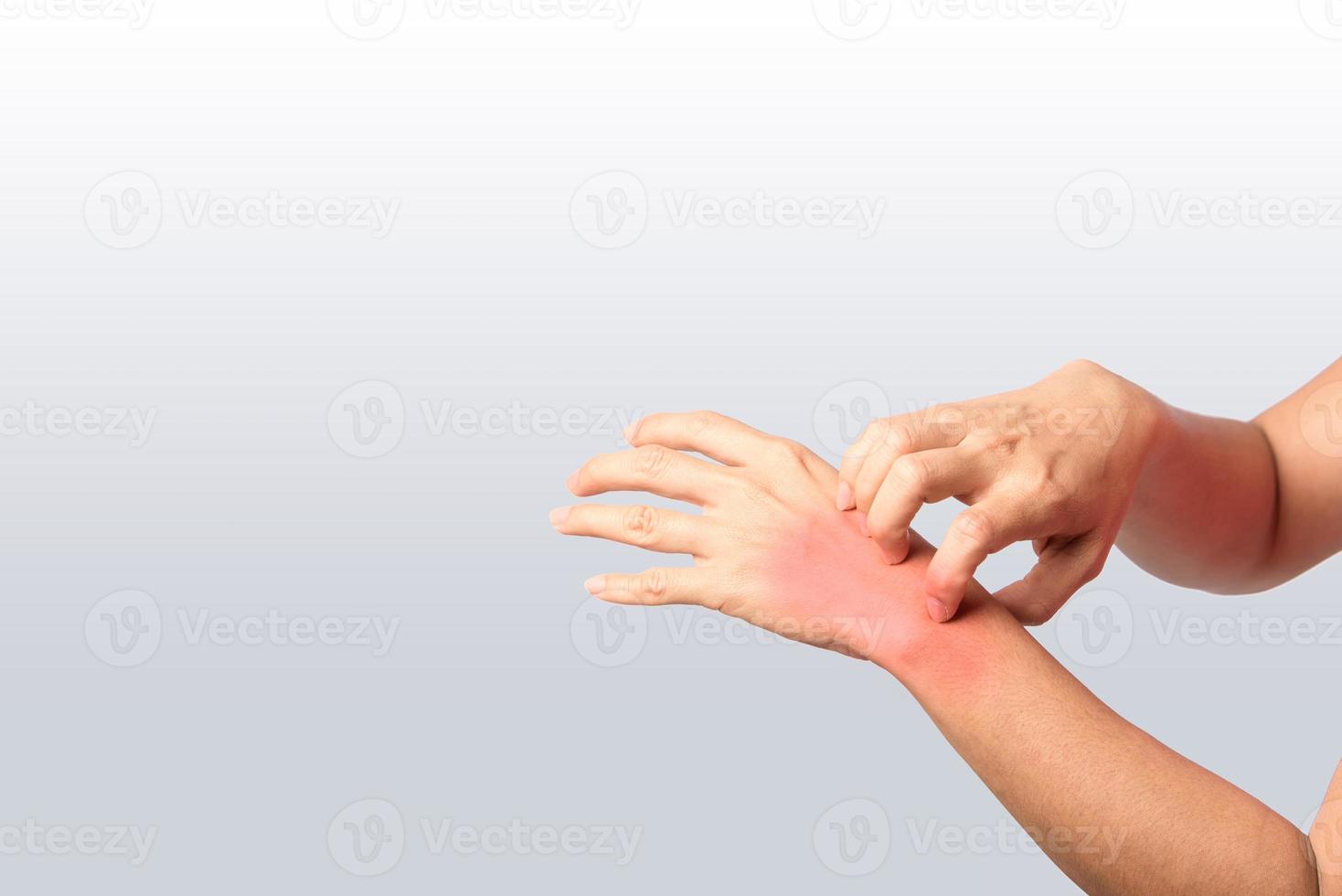 woman scraching rash at wrist joint photo