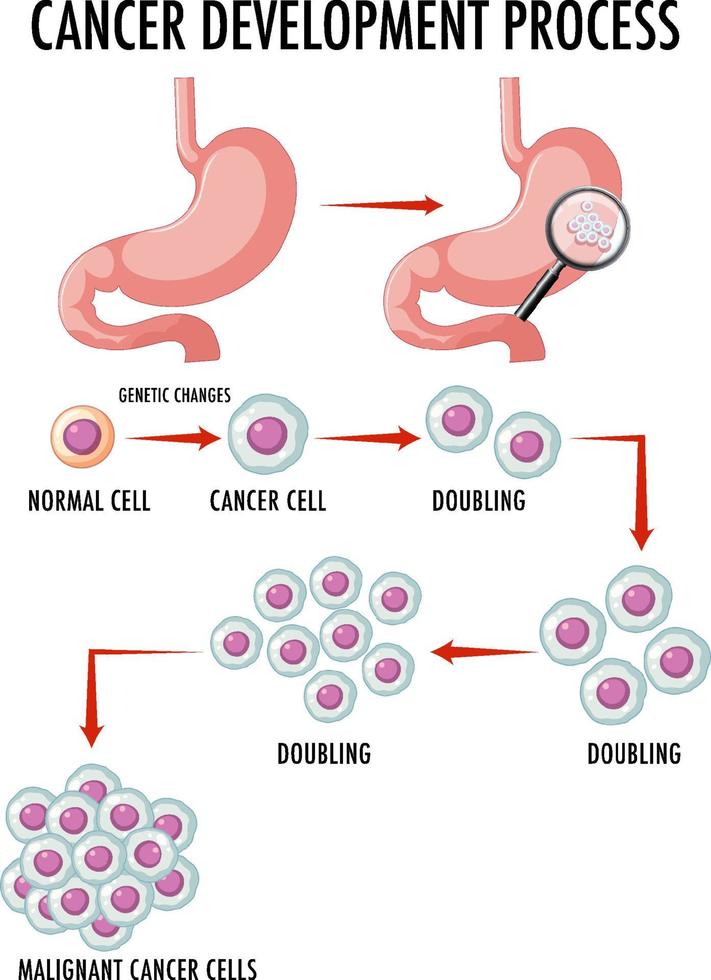 Diagram showing cancer development process vector