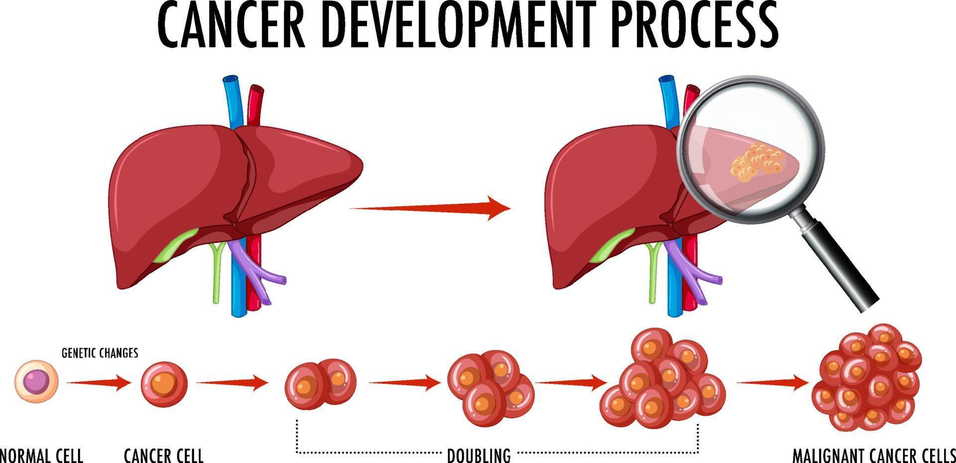 Diagram showing normal and cancer cells in human vector