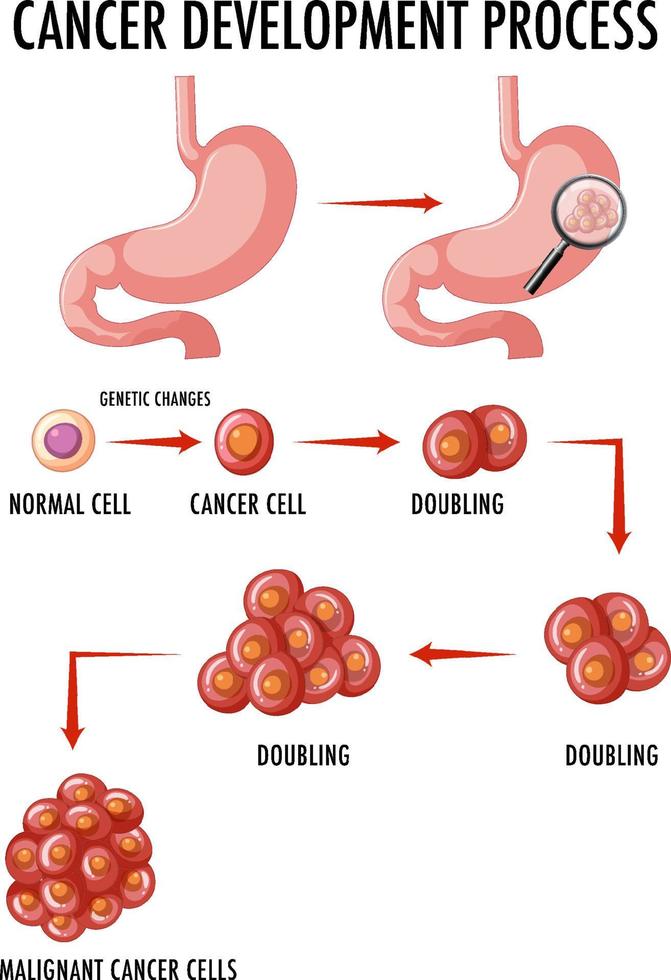 Diagram showing cancer development process vector