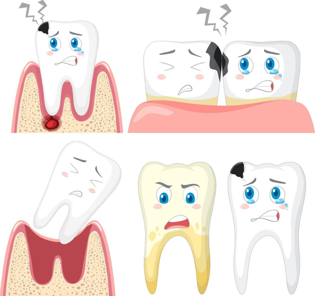 conjunto de caries dental sobre fondo blanco vector