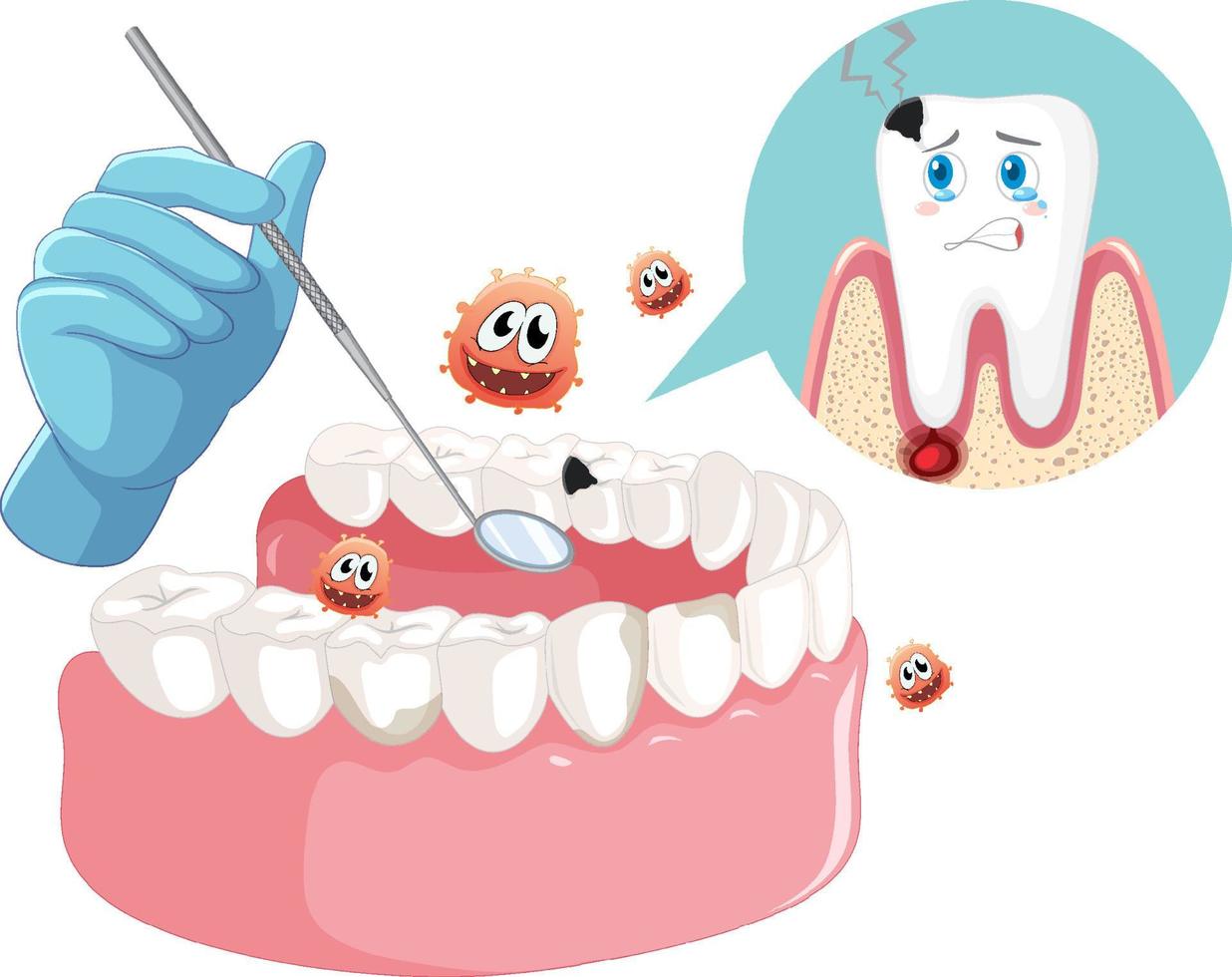 mano de dentista con modelo de caries de dientes humanos vector