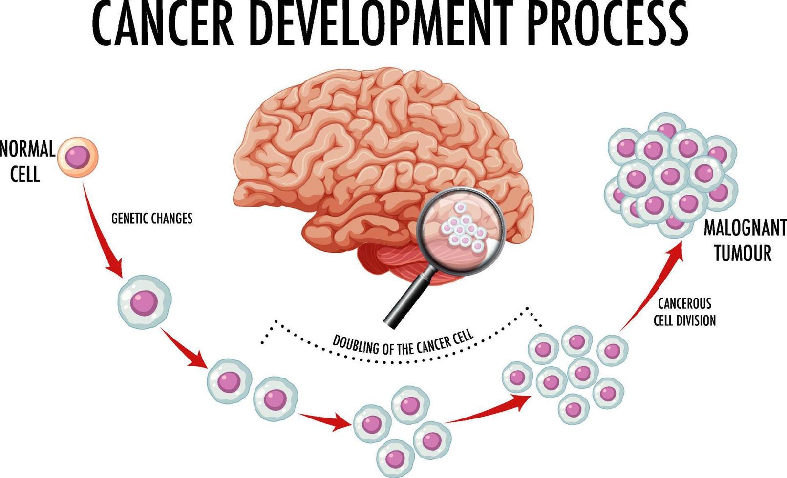 diagrama que muestra el cerebro humano y el cáncer vector