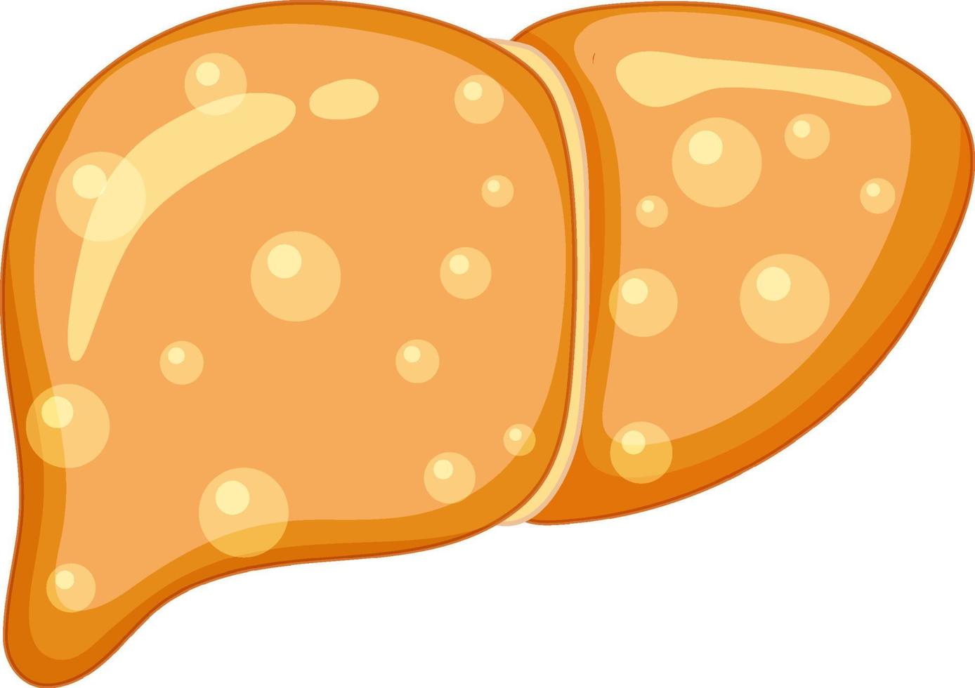 Fat Liver on white background vector