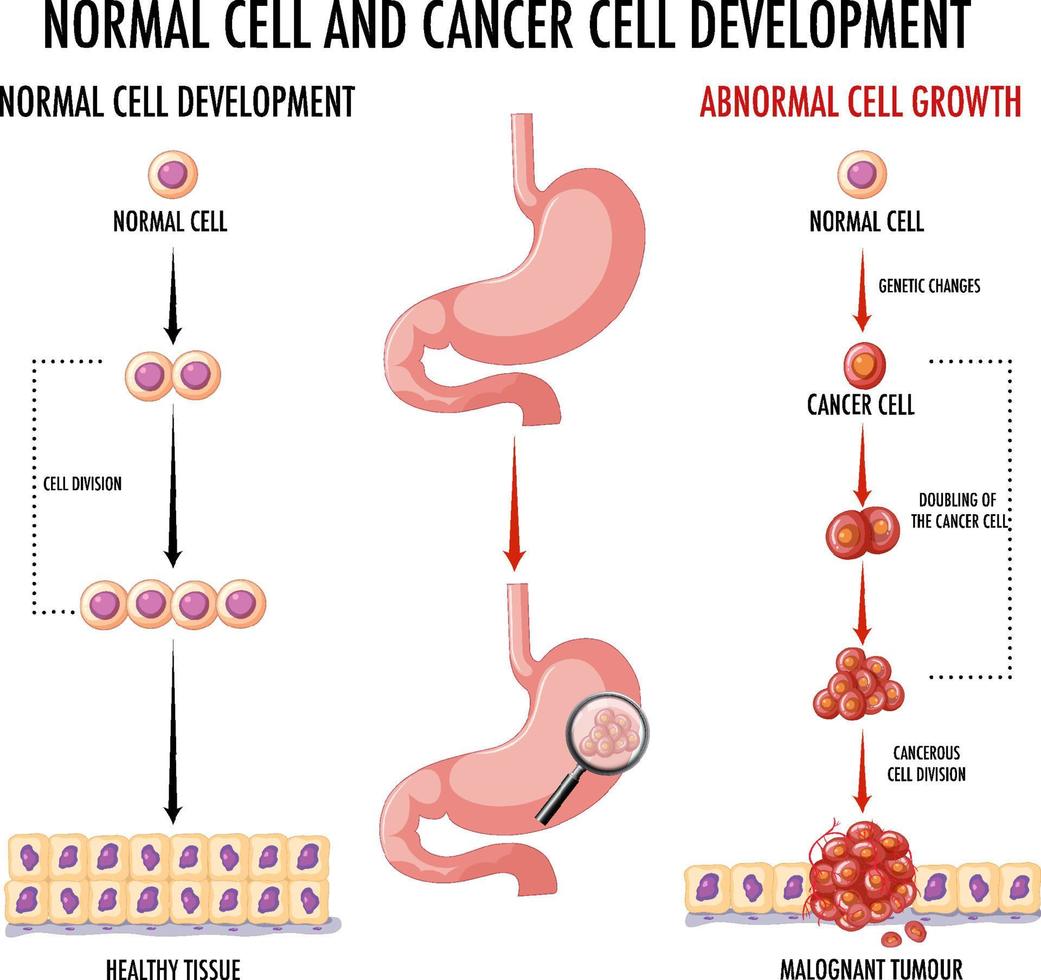 diagrama que muestra células normales y cancerosas vector