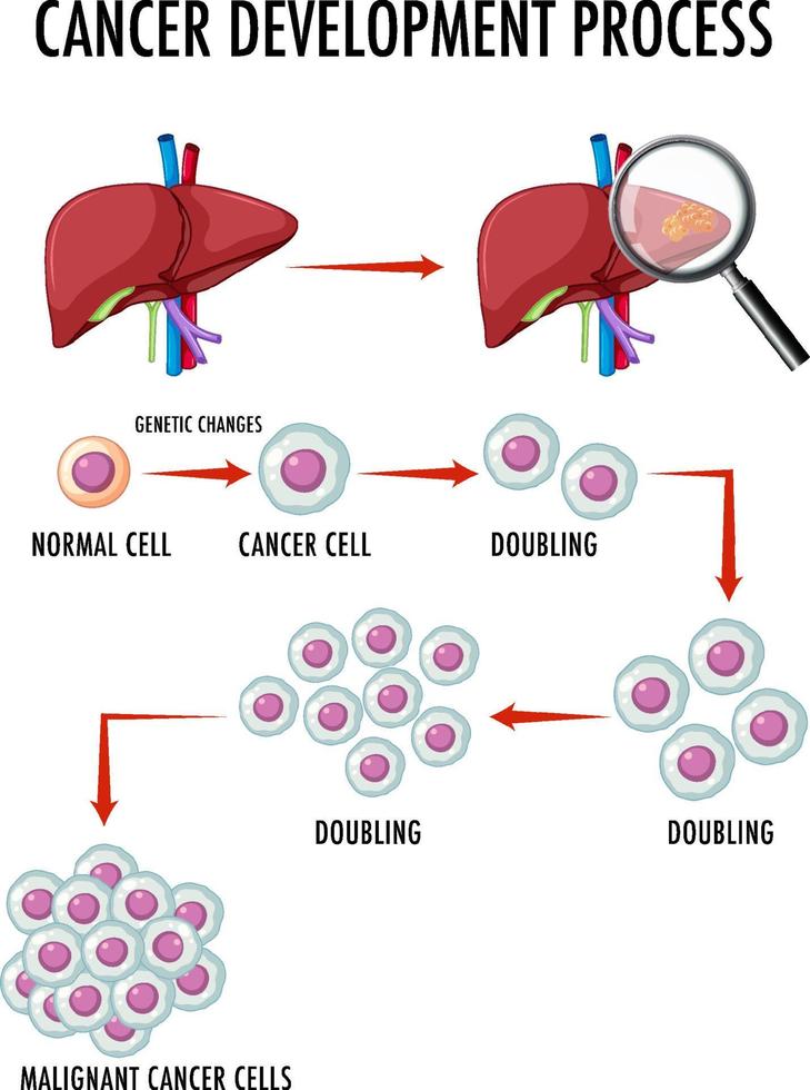 diagrama que muestra el proceso de desarrollo del cáncer vector