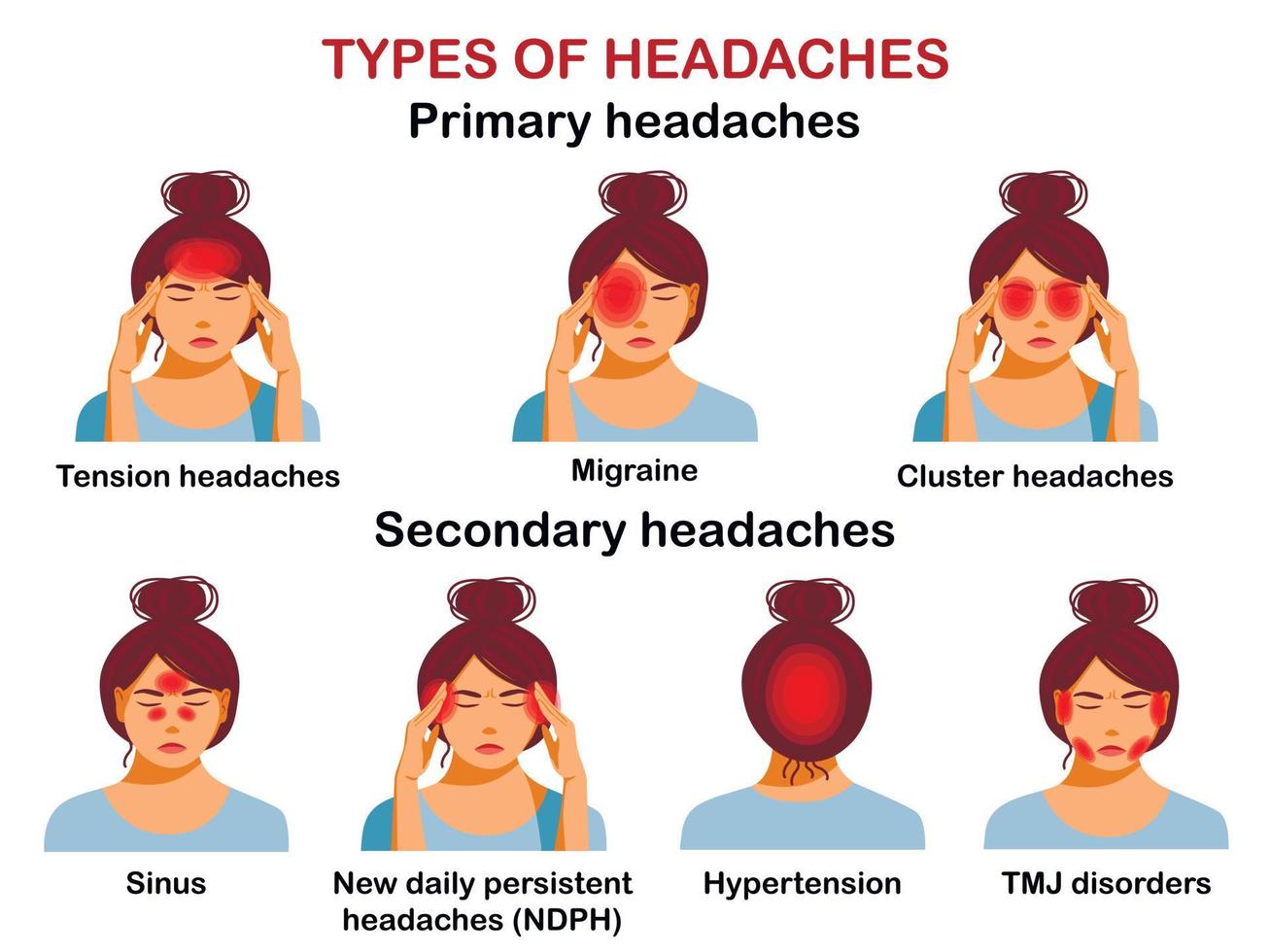 Types of headaches. Vector Infographic.