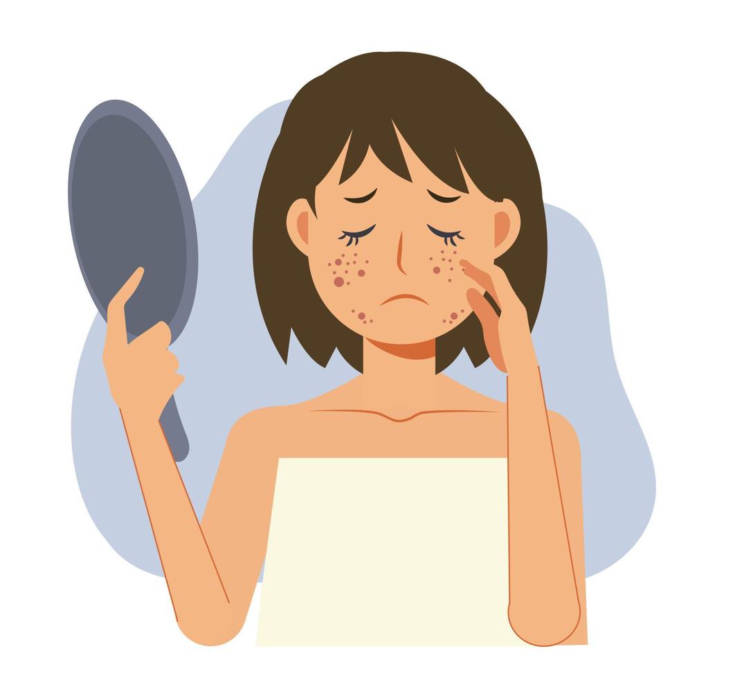 Acne skin problems Concept.Woman holding mirror is getting sad due to acne on her facial.Flat vecor cartoon character illustration. vector