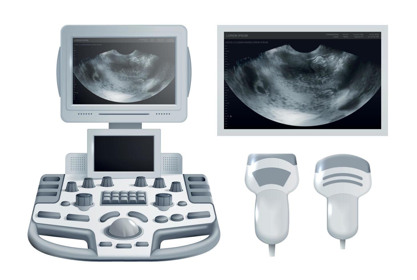 equipo de control de ultrasonografía médica vector