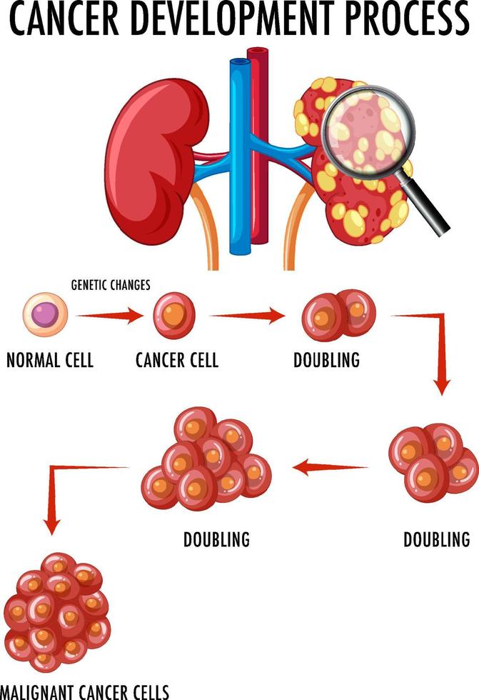 Diagram showing cancer development process vector