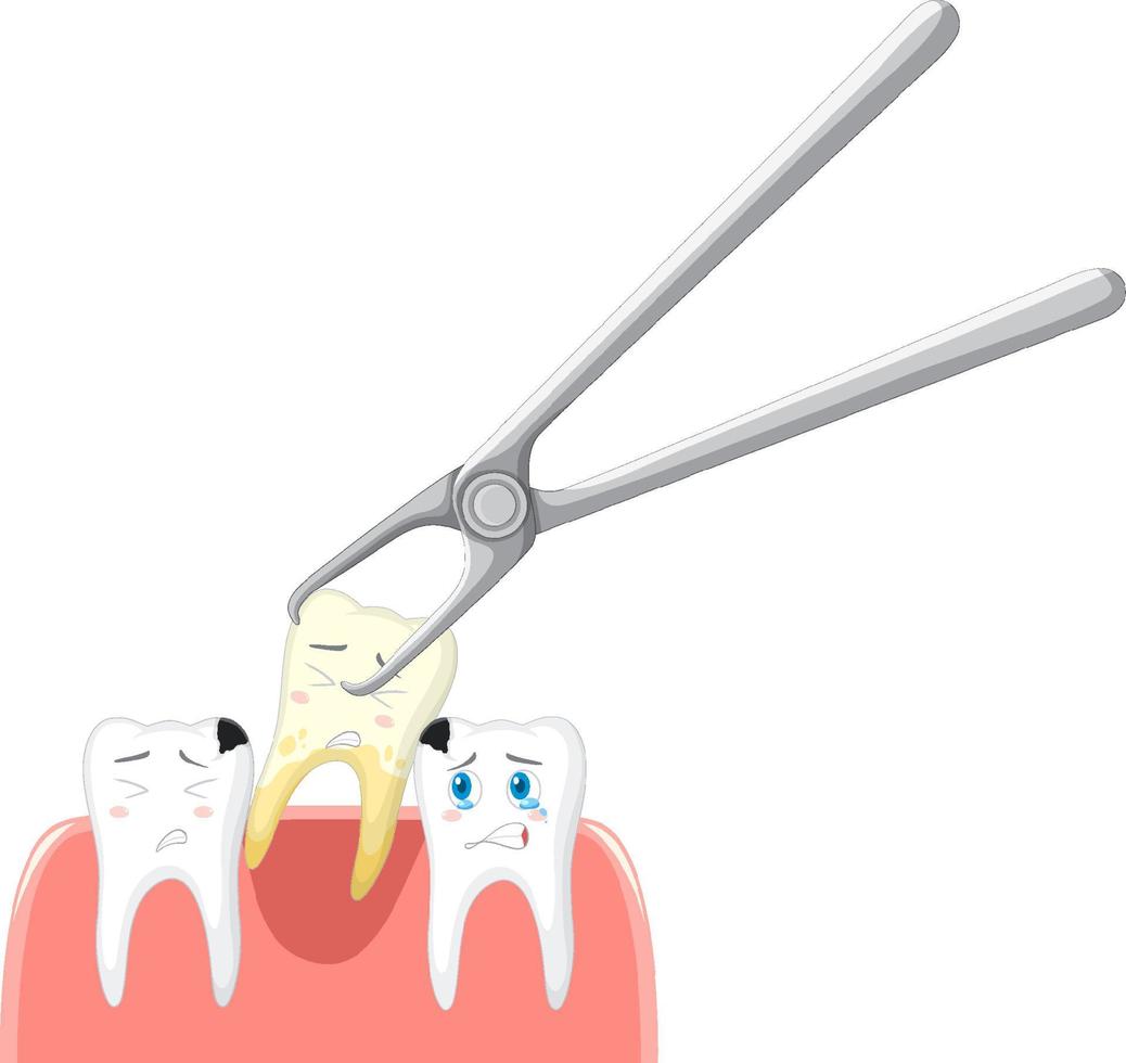 extracción de dientes de dibujos animados sobre fondo blanco vector