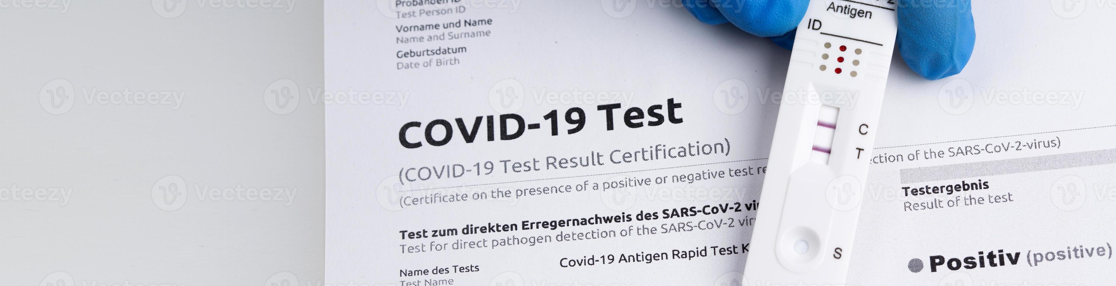 Positive test result by using rapid test device for COVID-19. photo