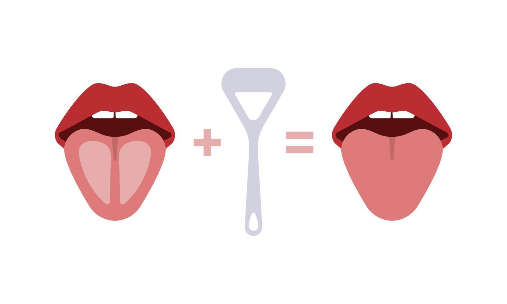 Tongue cleaner illustration. Scraper for mouth. White coating. Halitosis prevention. Vector