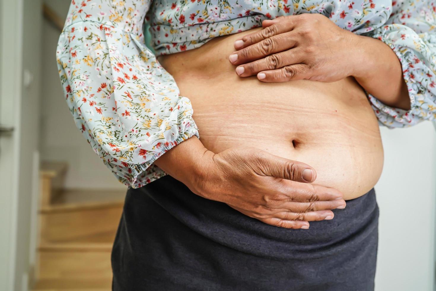 la mujer asiática muestra un vientre gordo de gran tamaño con sobrepeso y obesidad en la oficina. foto