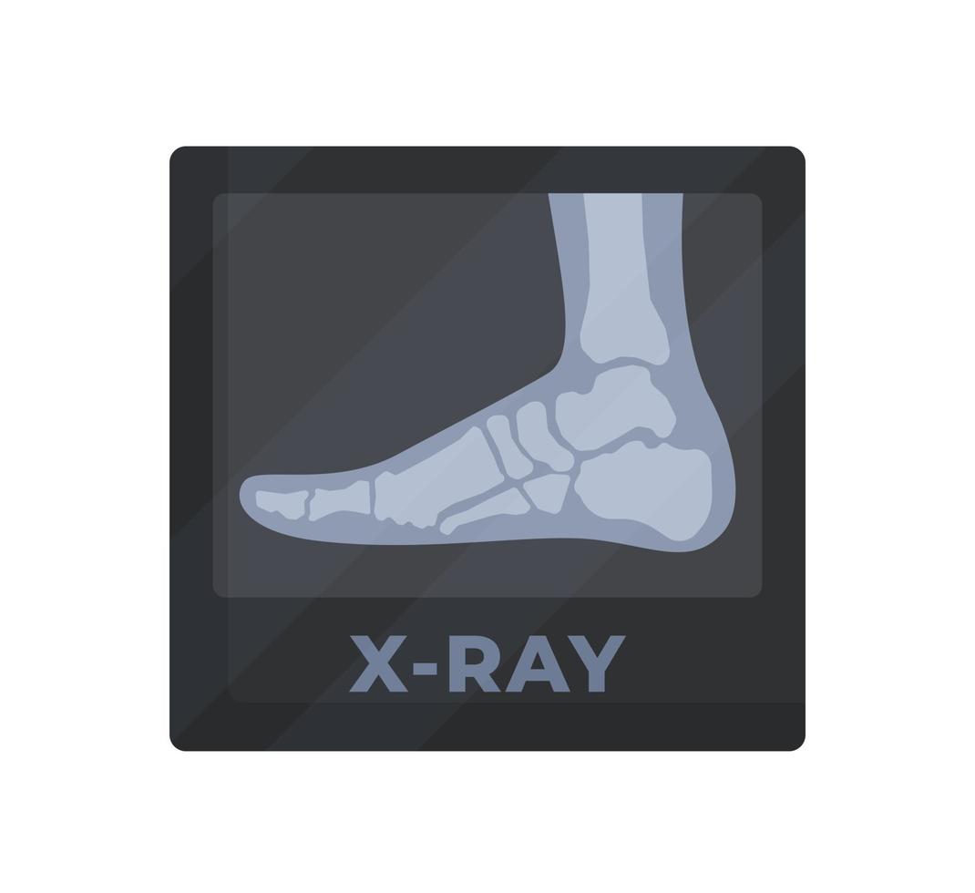 Vector illustration of x-ray leg. Painful leg. Whole and healthy leg.