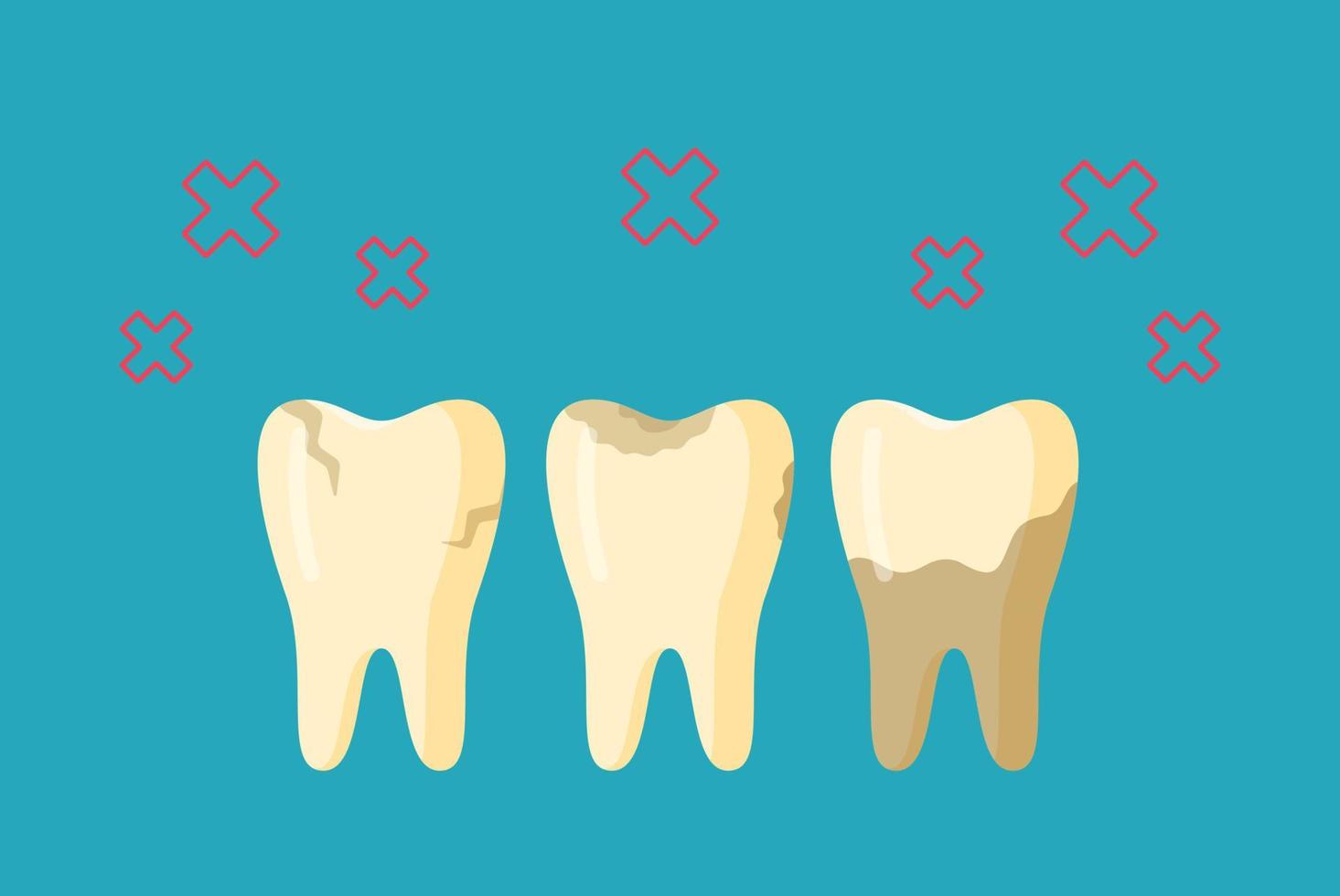 ilustración vectorial de diente dolorido. sarro en los dientes. no higiénico. vector