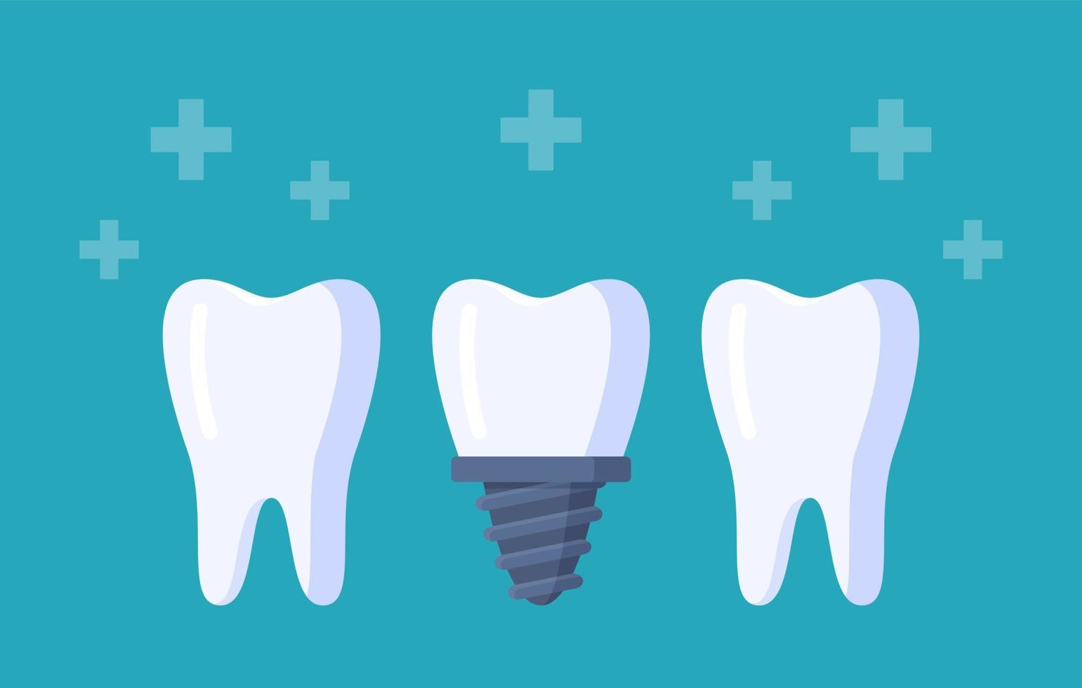 Vector illustration of tooth row. Three teeth isolated on a blue background.