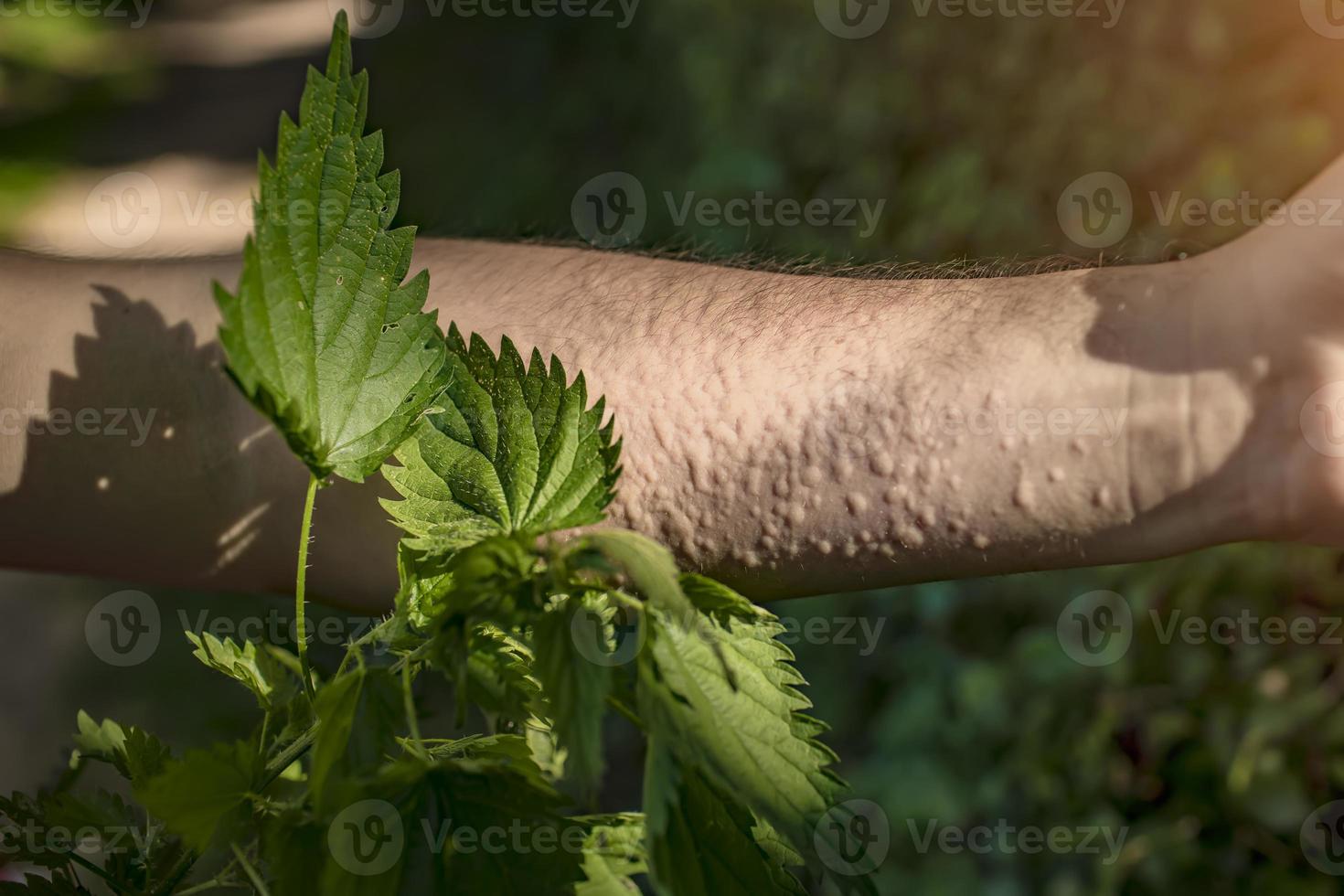 scorch your hands with nettles closeup photo