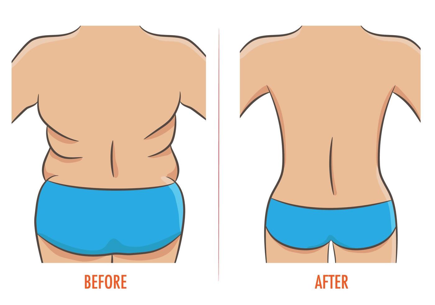 concepto de problema grueso y delgado con sobrepeso. torso femenino con hombros, espalda y caderas gordos y magros. espalda antes y después de la dieta, fitness o liposucción. ilustración vectorial de la parte trasera de la mujer, aislada vector