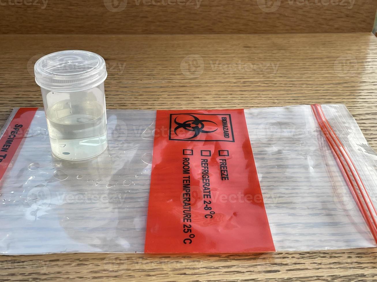 Urine specimen in transparent plastic bottle photo