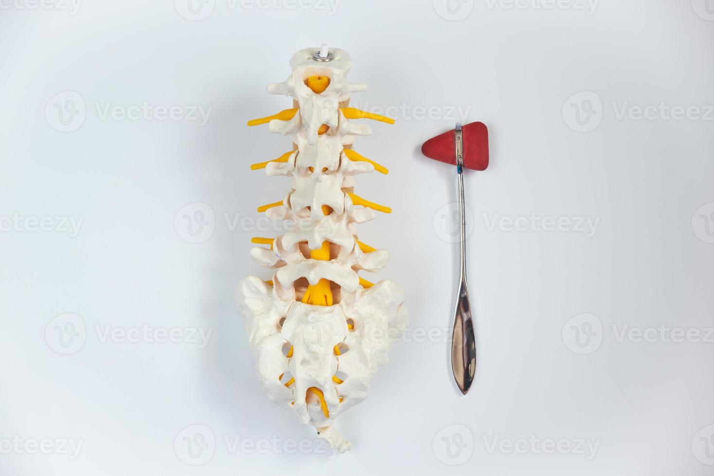 Top view of lumbar spine model and reflex hammer. photo