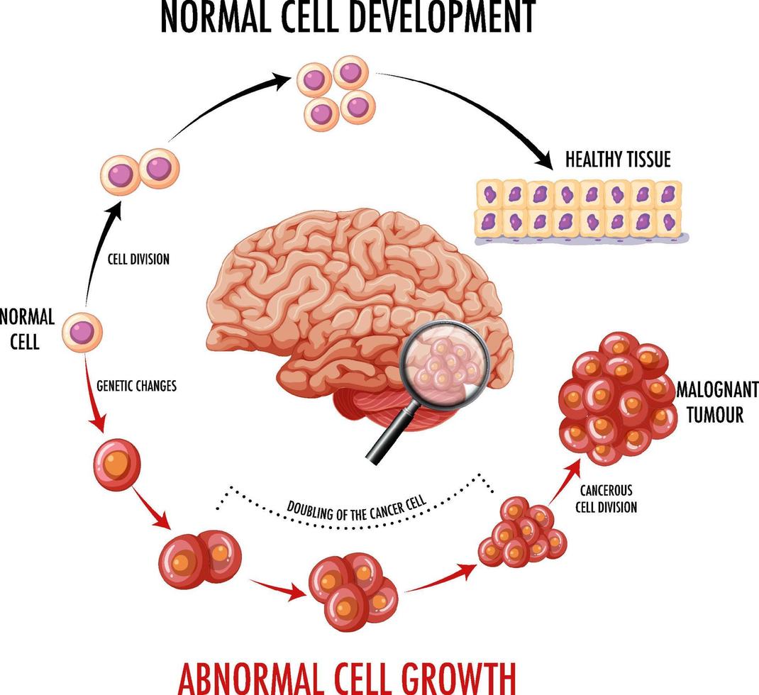 Diagram showing human brain and cancer vector