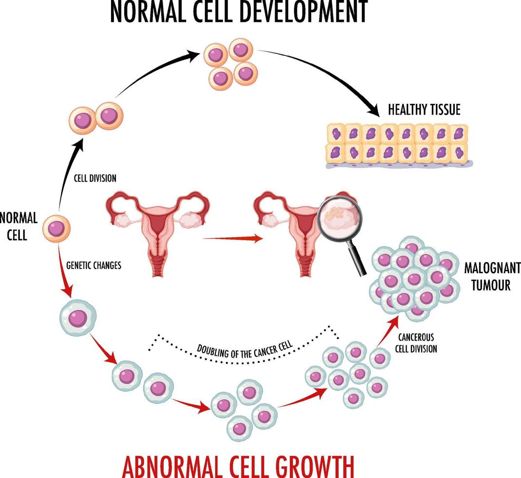 diagrama que muestra células normales y cancerosas vector