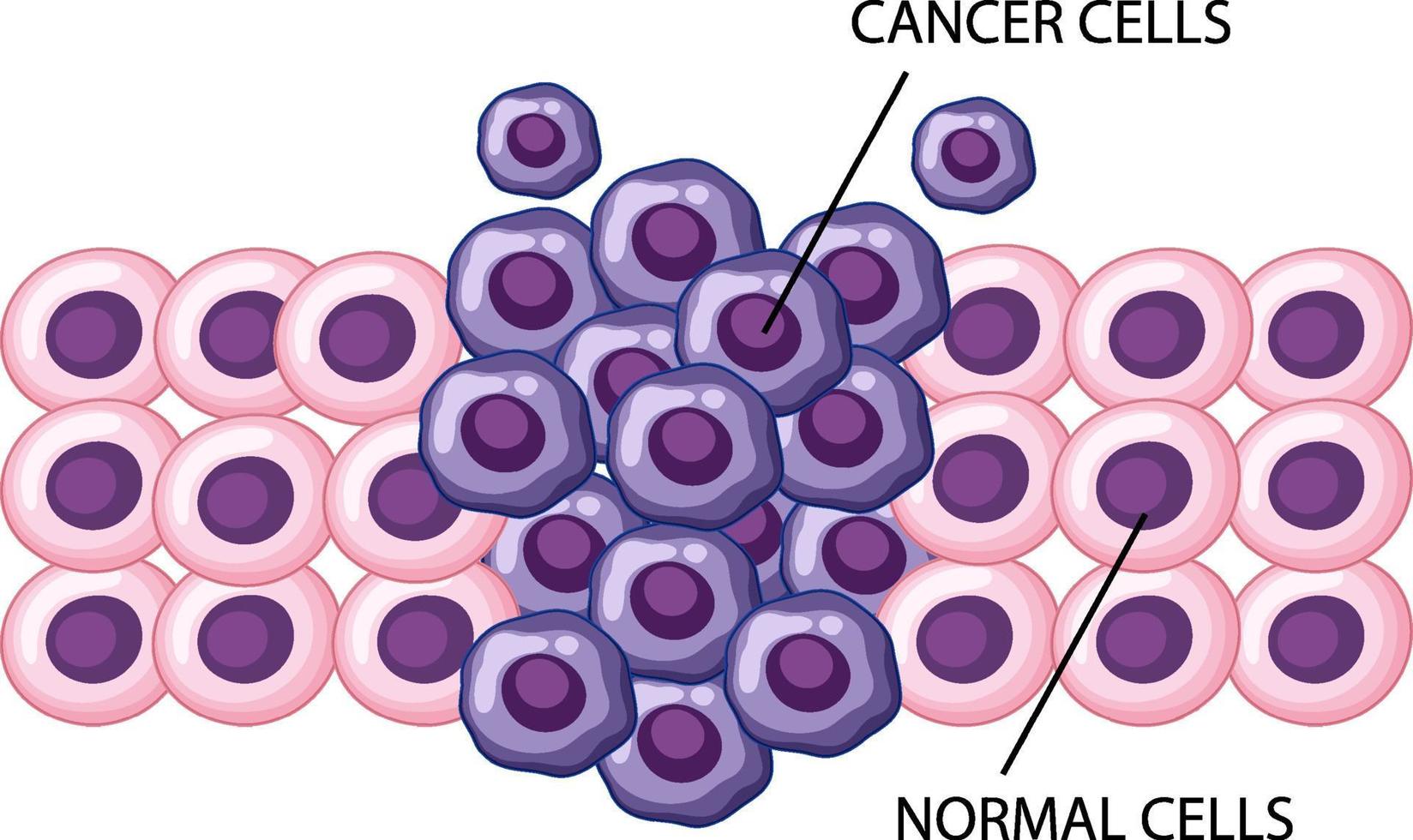 proceso de desarrollo de células cancerosas vector