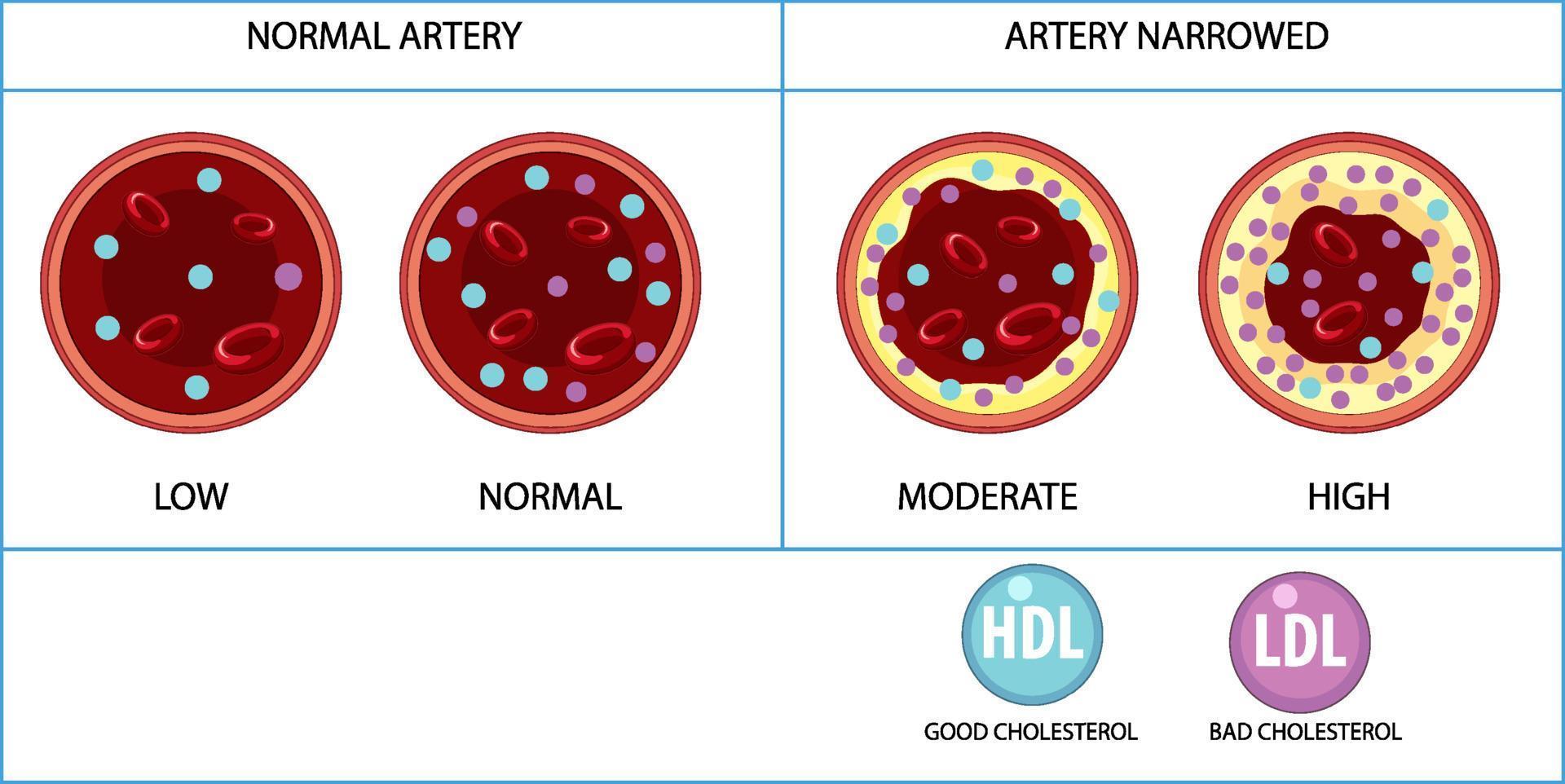 Types of Cholesterol HDL and LDL vector