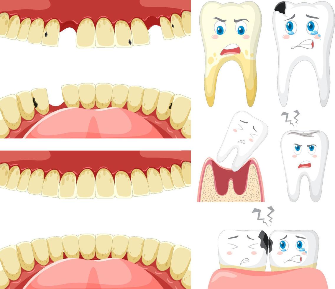 Set of all types of teeth on white background vector