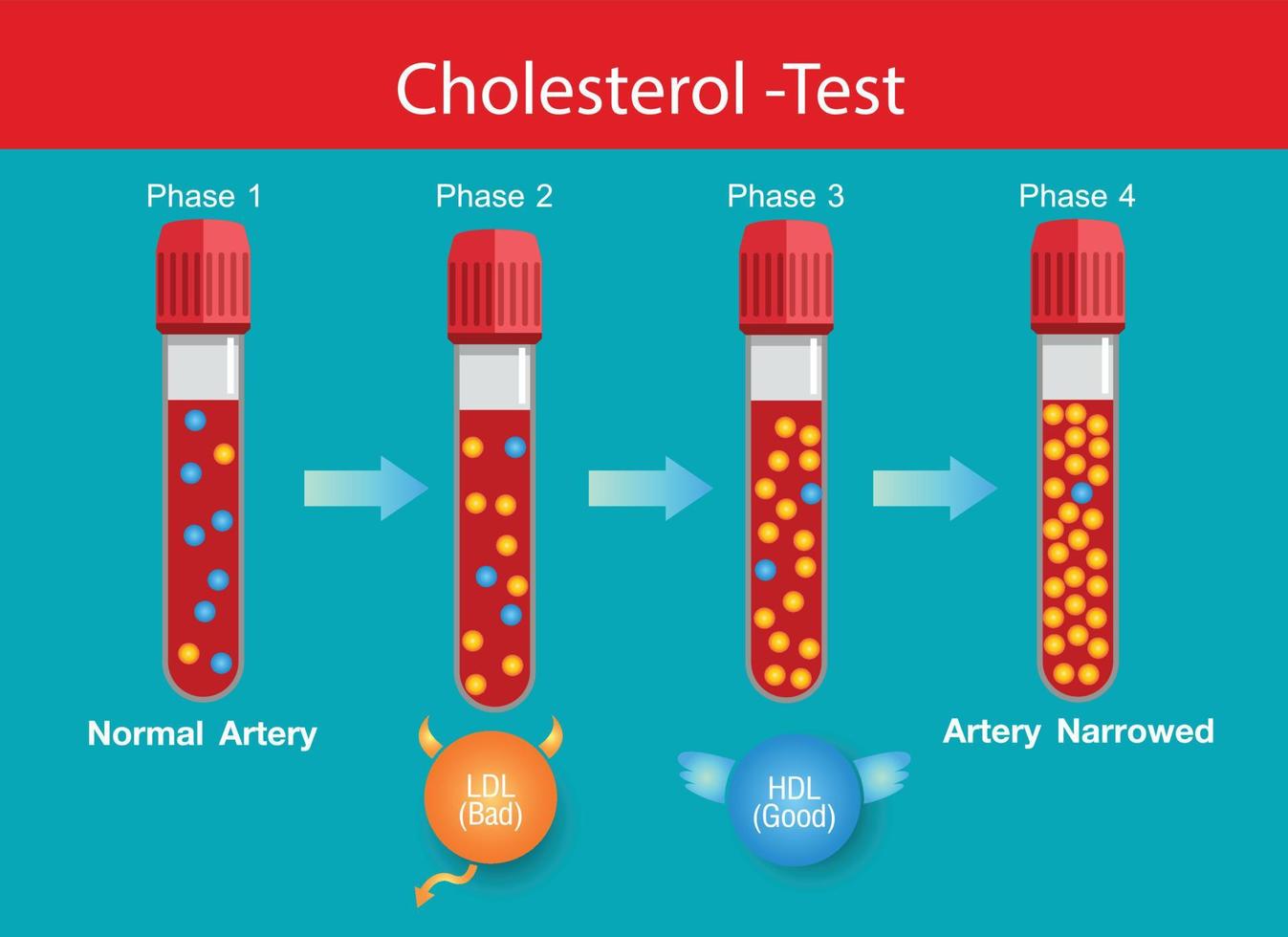 Cholesterol in artery, health risk , Levels of cholesterol, vector design