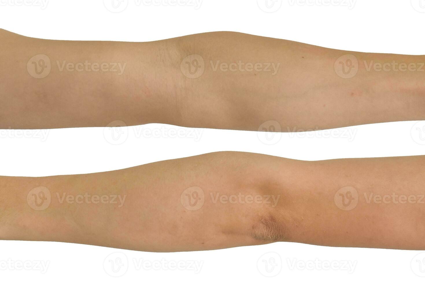 Front and back arms isolated on white background. with clipping path. photo