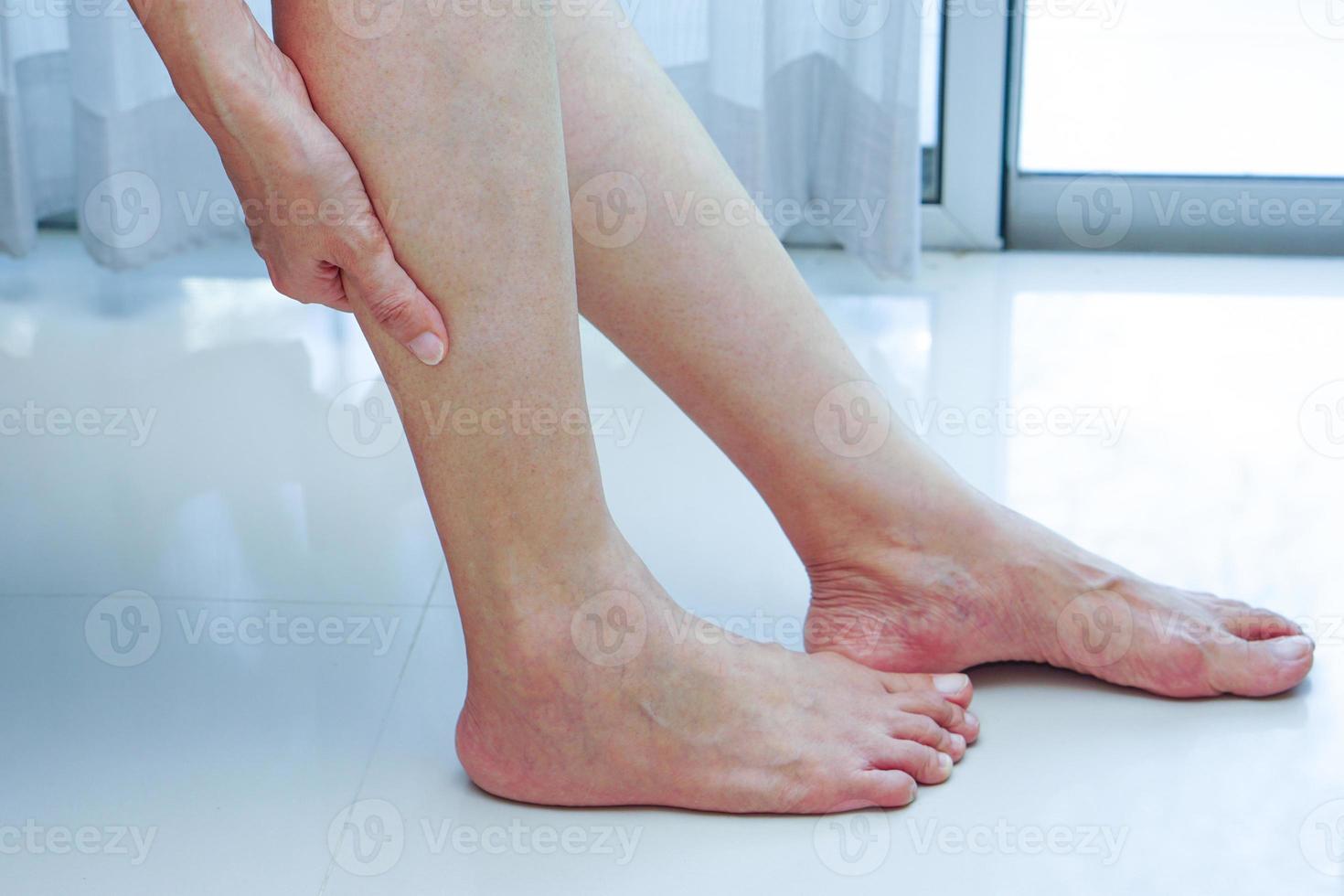 Woman suffering from leg pain. photo