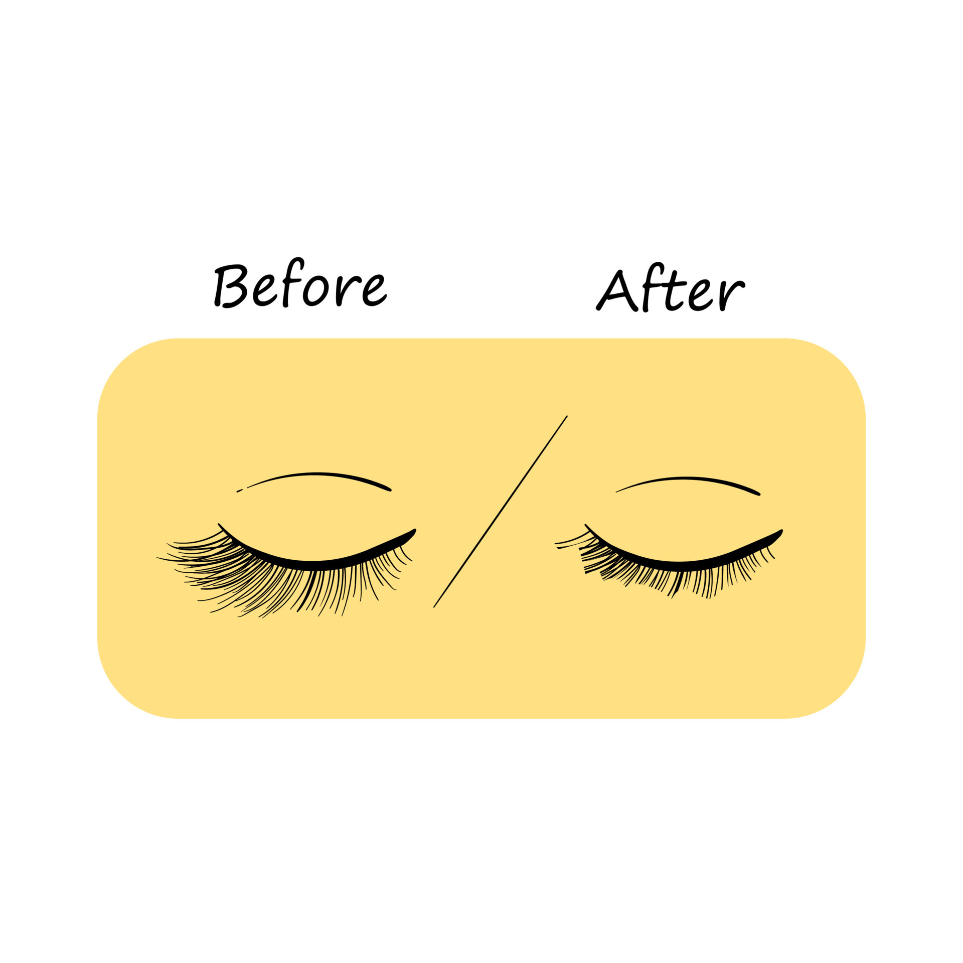 Eyelash extension. Improper eyelash extensions. Consequences of eyelash extensions. Harmful