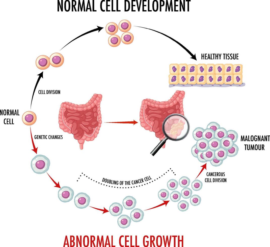 Cancer Development Diagram