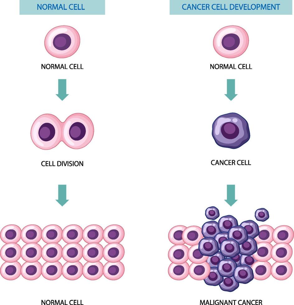 proceso de desarrollo de células cancerosas vector