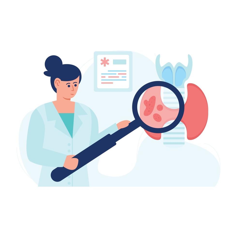 A high quality flat illustration of arthroplasty vector