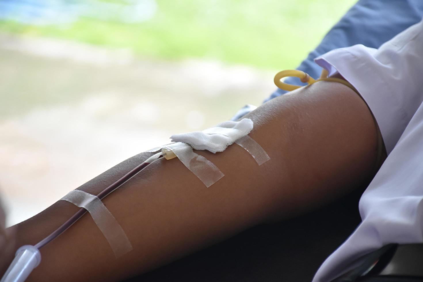el brazo de un donante de sangre, que tiene una aguja y un tubo de plástico transparente para llevar sangre a una bolsa de sangre de la cruz roja. foto