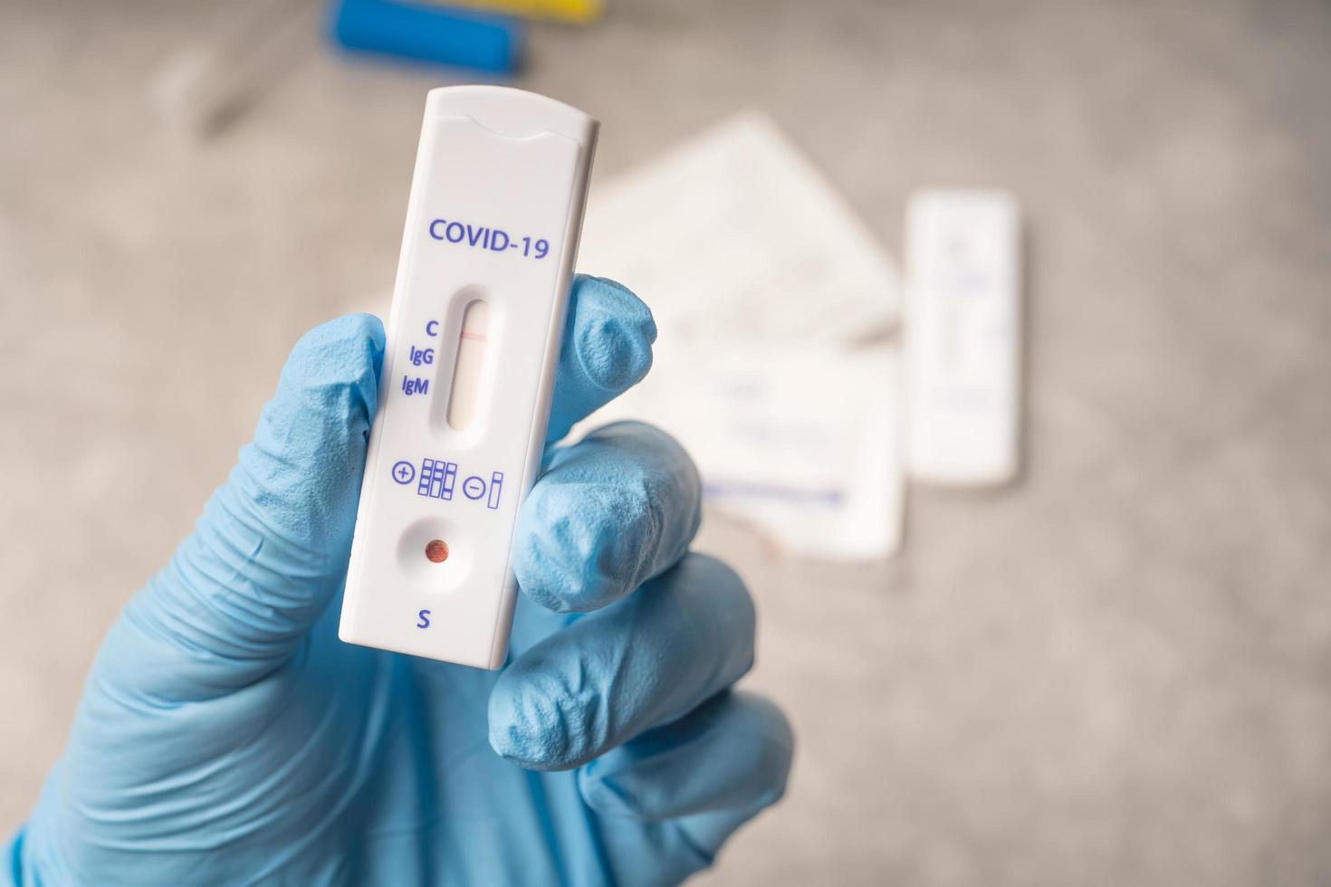 Man holding Corona Covid-19 Rapid Antigen Test RST kit ,Antibody Test with negative result at  home photo