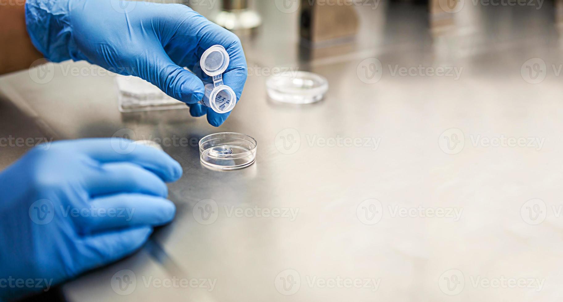 Hands of a scientist in the laboratory with a test tube and a microscope. The invention of the vaccine, a doctor in the clinic of artificial insemination IVF. Tests, fertilization of the egg photo