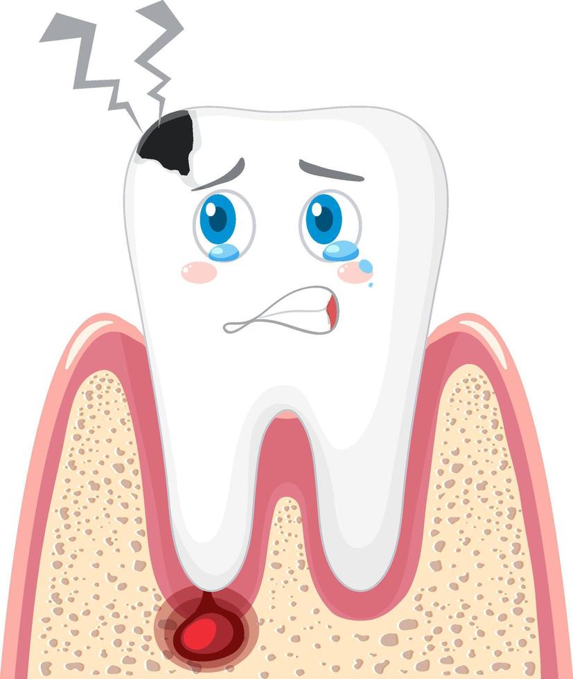 caries e inflamación en las encías sobre un fondo blanco vector