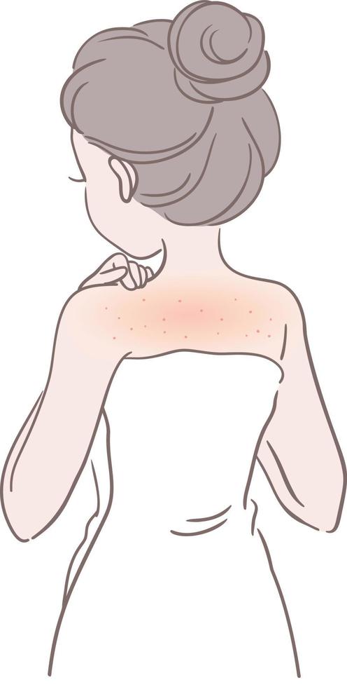 Folliculitis on Skin vector