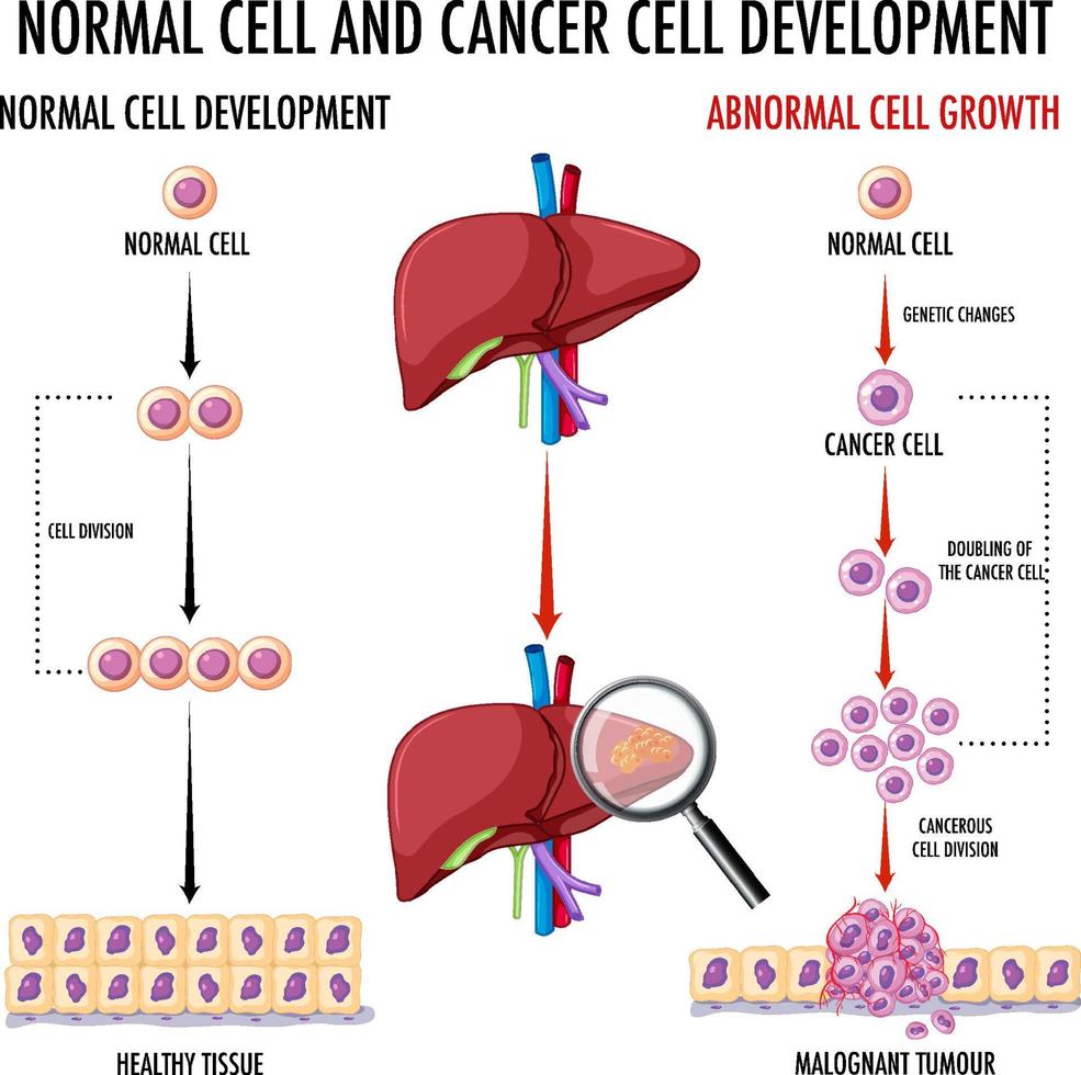 Diagram showing cancer development process vector